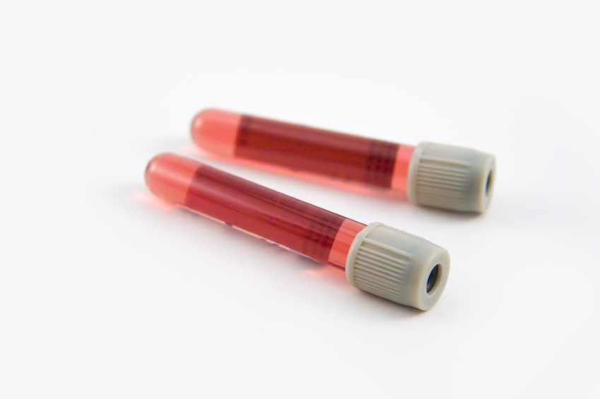 Groupe Santé Vernailles Inc. | 581 Boulevard Lacombe b, Repentigny, QC J5Z 3J7, Canada | Phone: (514) 727-0909