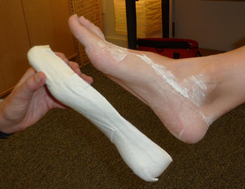 MediFeet Clinic & Orthotics (Mississauga South) | 1840 Lakeshore Rd W, Mississauga, ON L5J 1J7, Canada | Phone: (905) 822-3338