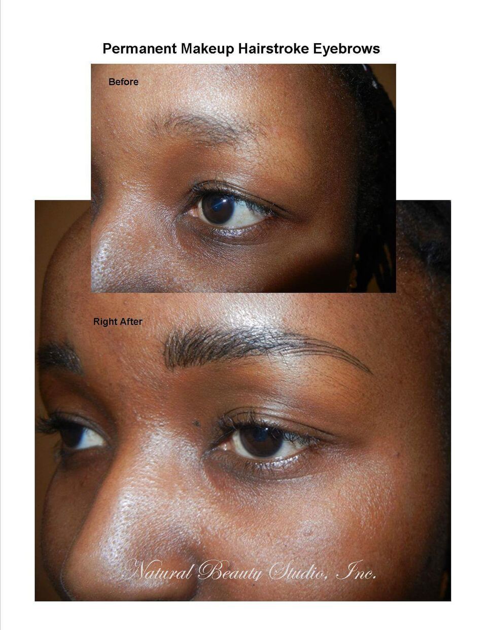 Natural Beauty Studio, Inc. | Southtowns Medical and Professional Park, 4535 Southwestern Blvd #205b, Hamburg, NY 14075, USA | Phone: (716) 713-3822