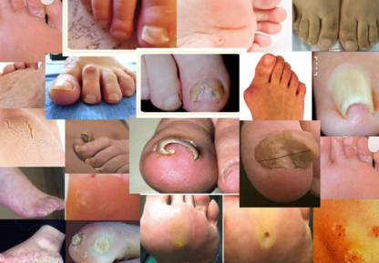 Beaux pieds Belles mains | doctor | 17165 Av. Lussier, Saint-Hyacinthe, QC J2T 3B8, Canada | 4505026760 OR +1 450-502-6760
