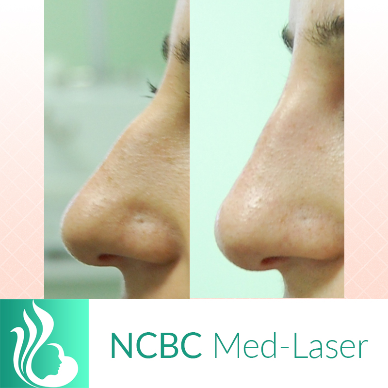 NCBC Med-Laser | hair care | 2090 Lawrence Ave E, Scarborough, ON M1R 2Z5, Canada | 4169314772 OR +1 416-931-4772