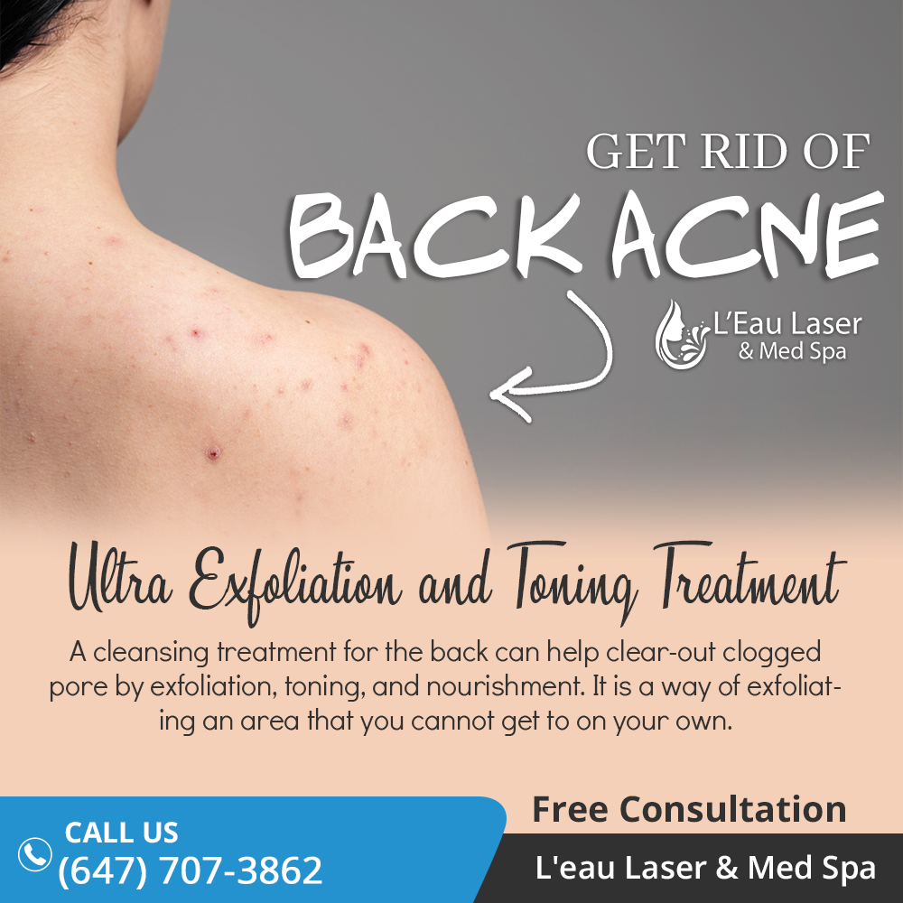 Leau Laser & Med Spa | 31 Blue Silo Wy., Brampton, ON L6X 5P6, Canada | Phone: (647) 707-3862