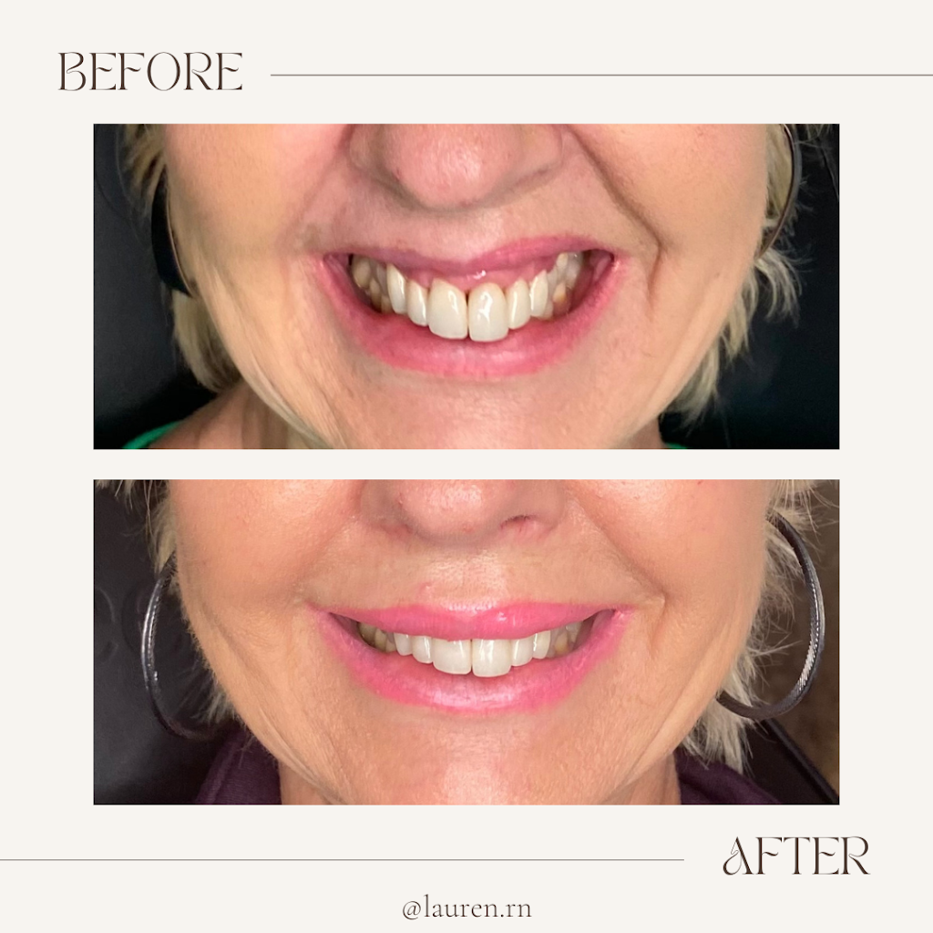 Lauren Landry RN - Halifax Injector: Botox and Dermal Fillers | 6461 Quinpool Rd, Halifax, NS B3L 1B1, Canada | Phone: (902) 789-1174