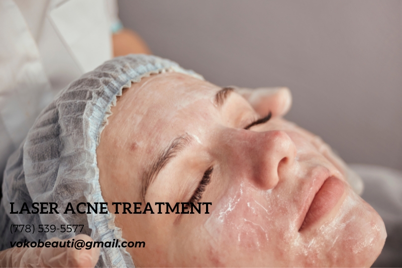 Voko Beauti Laser & Skin Care Clinic Chilliwack | 6396 Sumas Prairie Rd #3, Chilliwack, BC V2R 4N6, Canada | Phone: (778) 539-5577