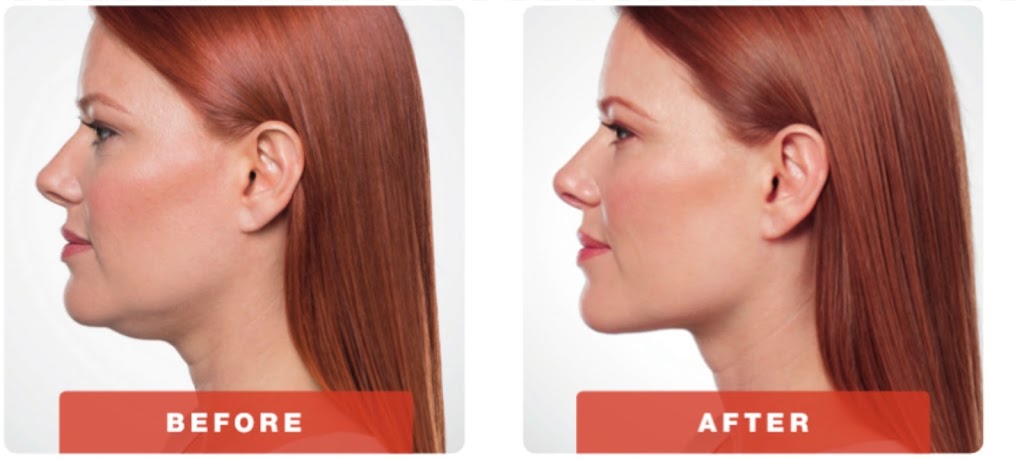 ABLC - Advanced Body & Laser Center | 165 Windham Ln, Grand Island, NY 14072, USA | Phone: (716) 628-7649