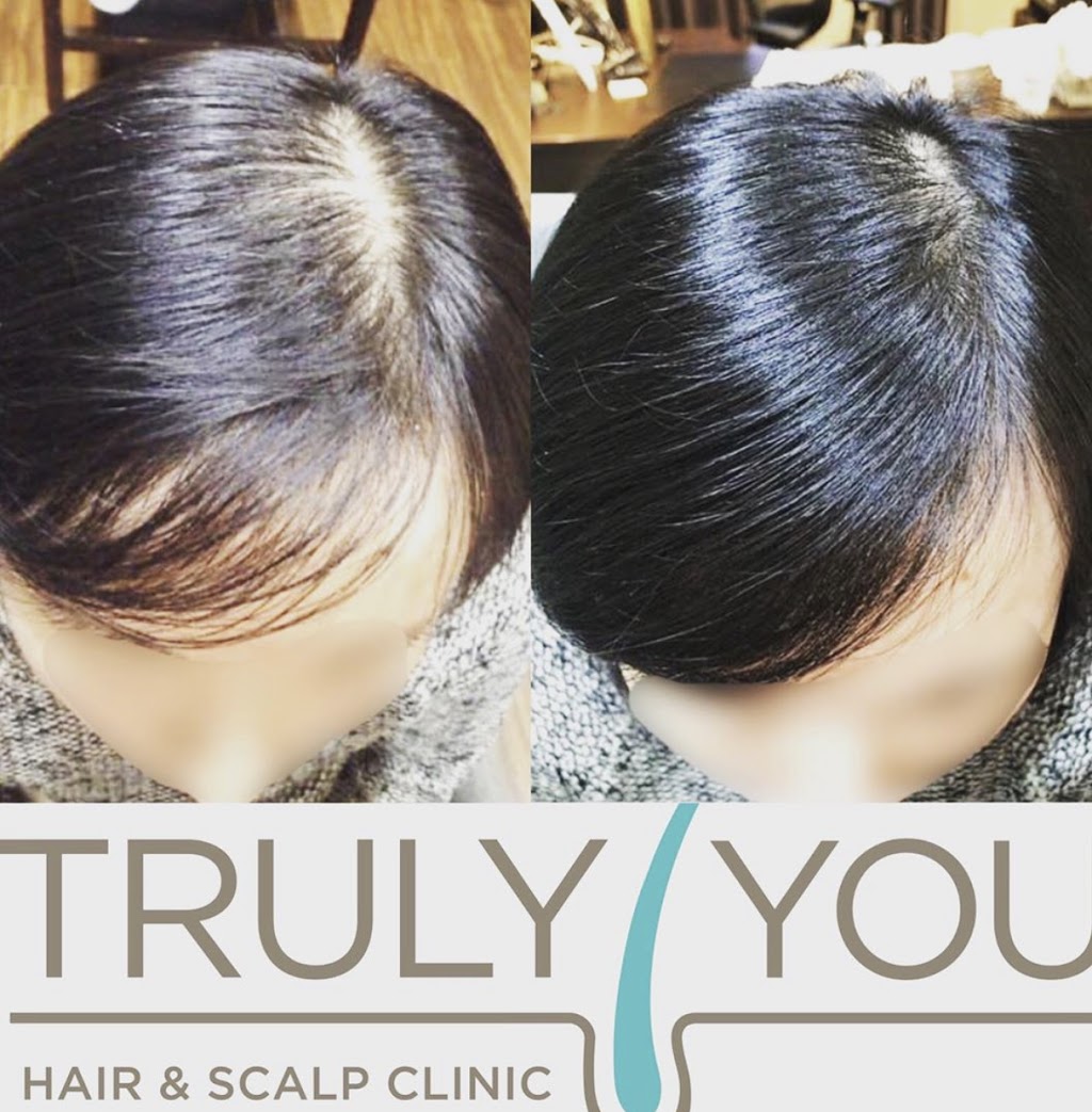 Truly You Hair and Scalp Clinic | 1225 Queensway E Unit #34, Mississauga, ON L4Y 0G4, Canada | Phone: (905) 821-1092