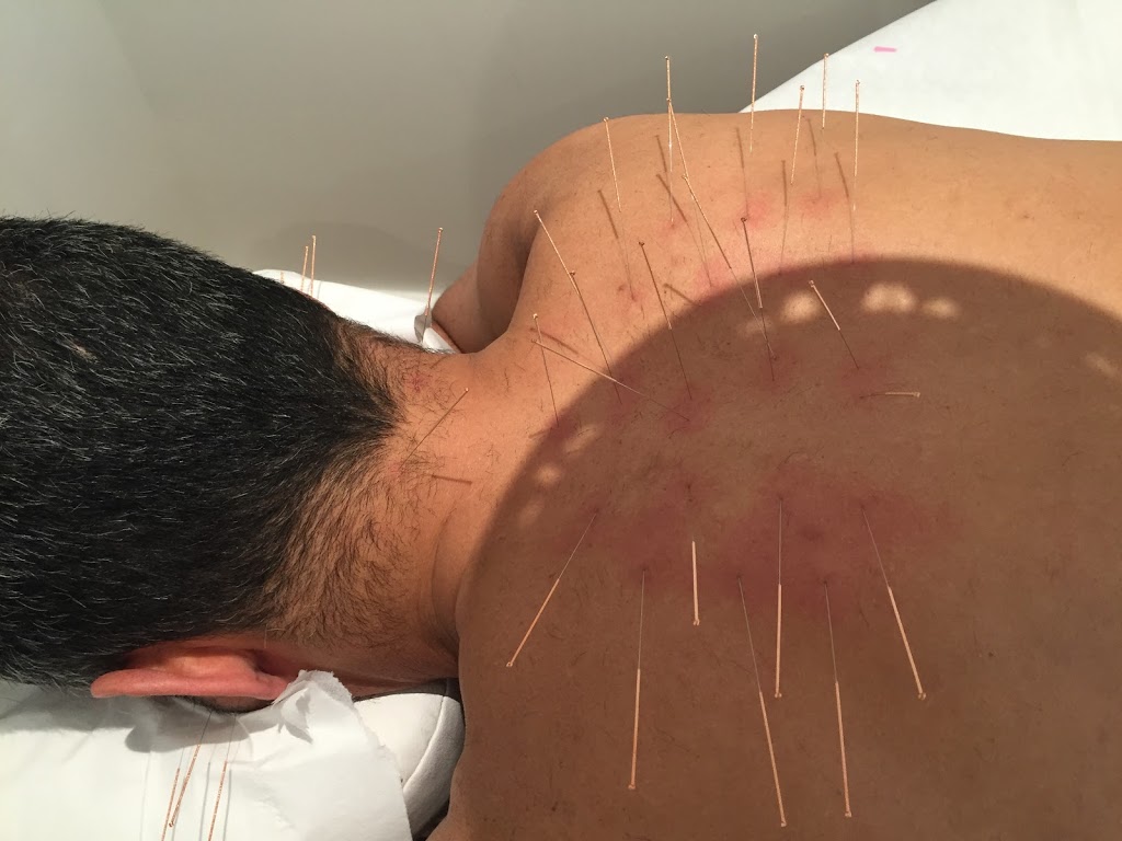 NuvoMed Montreal | 8 Avenue Glencoe, Outremont, QC H3T 1P9, Canada | Phone: (514) 531-8300