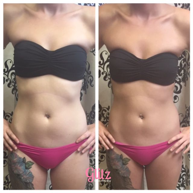 Glitz Spray Tanning | 1606 Sherwood Dr, Sherwood Park, AB T8A 1G5, Canada | Phone: (780) 691-8842