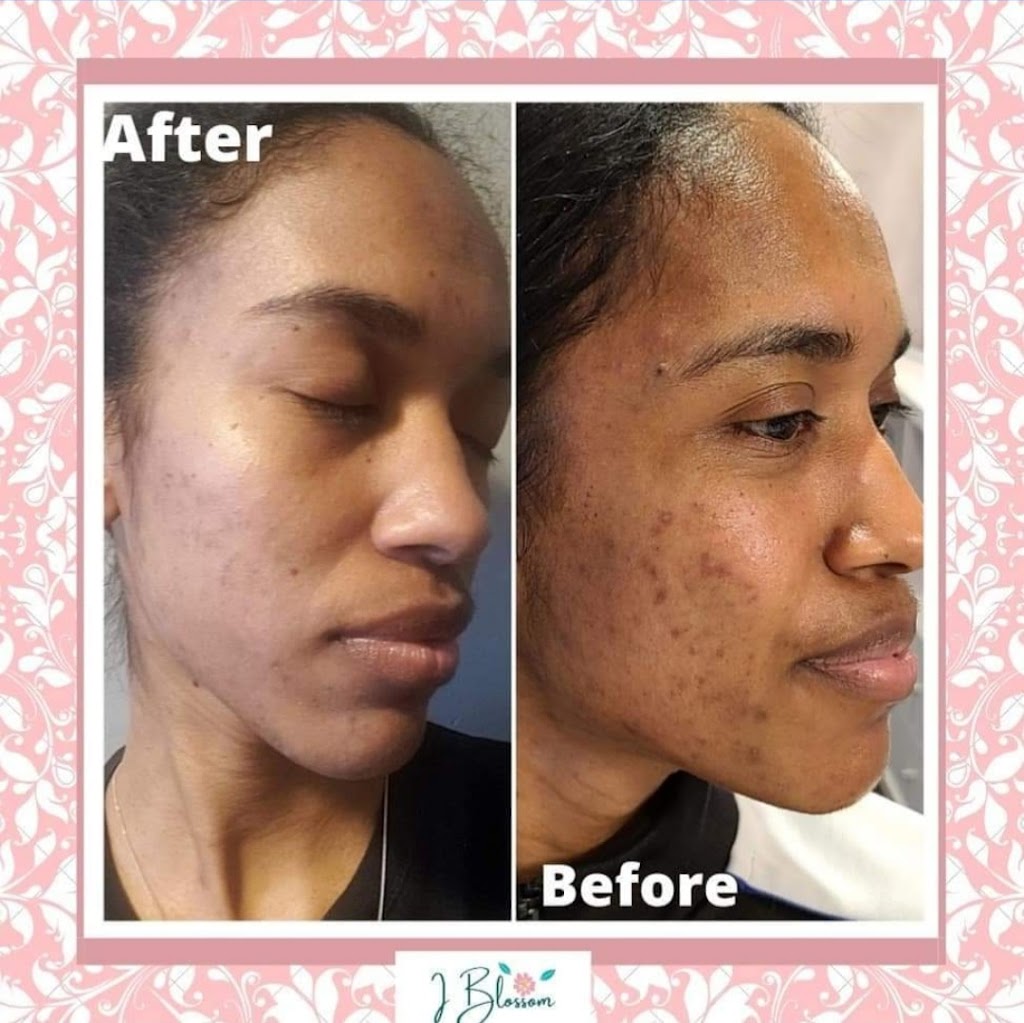 I Blossom Skincare | 119 Nash Rd S, Hamilton, ON L8K 4J8, Canada | Phone: (519) 321-0897