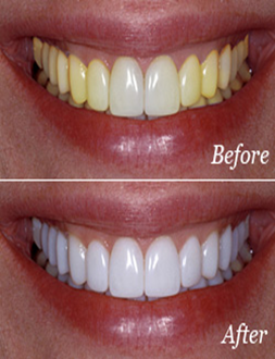 Surrey Dental Hygiene Clinic Inc | 12989 109 Ave, Surrey, BC V3T 2N2, Canada | Phone: (778) 395-0988