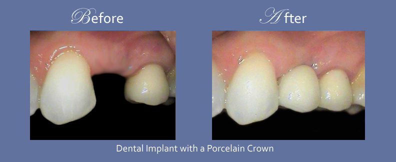 Westmount Dental | 8010 Bathurst St c4, Thornhill, ON L4J 0B8, Canada | Phone: (905) 881-8284