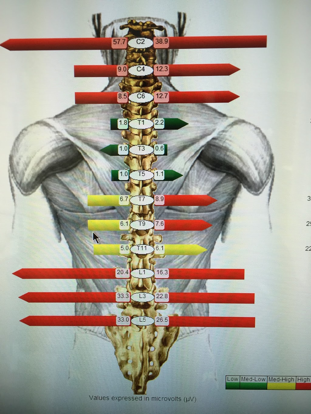 The Back Doctors Chiropractic Wellness | 3180 Harriet Rd, Victoria, BC V9A 1T8, Canada | Phone: (250) 381-1124