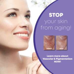 Vibrant U Aesthetics | 242 Baxter St, London, ON N5W 0A2, Canada | Phone: (519) 617-8772