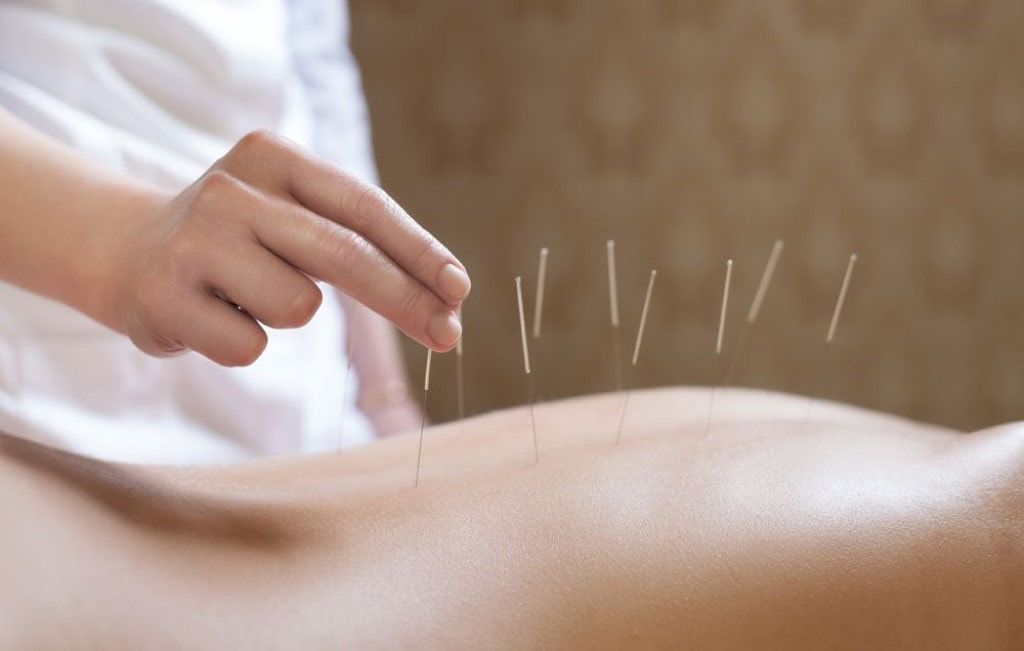 TruRelief Wellness Massage & Acupuncture | 108 Shawville Pl SE Unit 130, Calgary, AB T2Y 0V2, Canada | Phone: (587) 718-7768