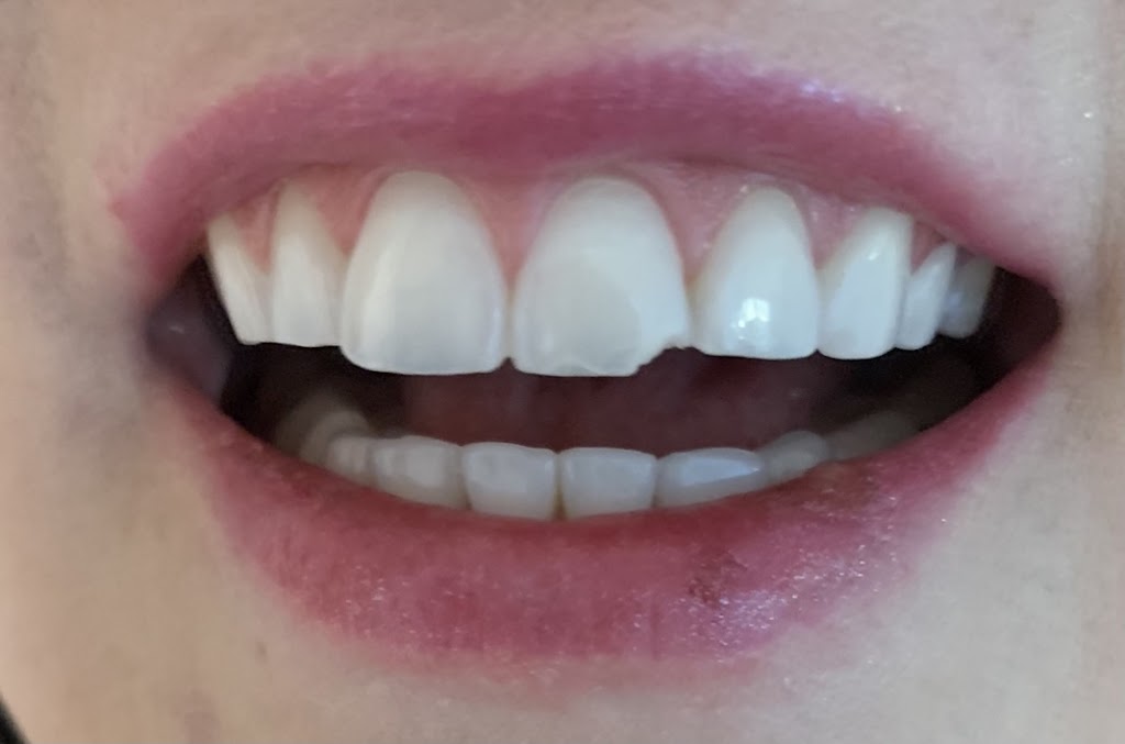 Duggan Family Dental | 4011 106 St, Edmonton, AB T6J 2S3, Canada | Phone: (780) 436-9730