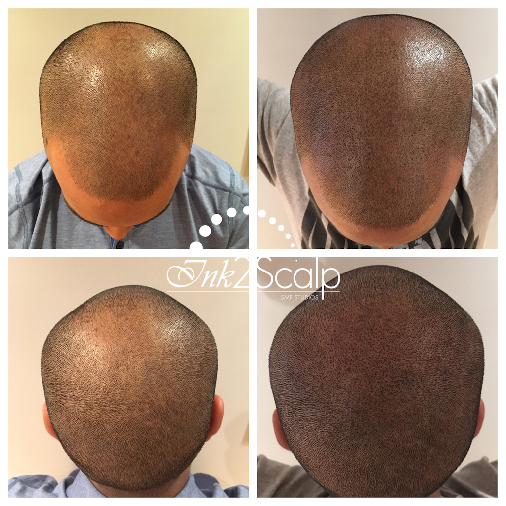 Ink2scalp | 6 Teardrop Crescent, Whitby, ON L1M 2N9, Canada | Phone: (905) 259-1251