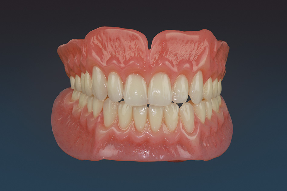 Firas Hajjar Denturologiste | 643 Rue Adoncour, Longueuil, QC J4G 2P6, Canada | Phone: (450) 651-2727