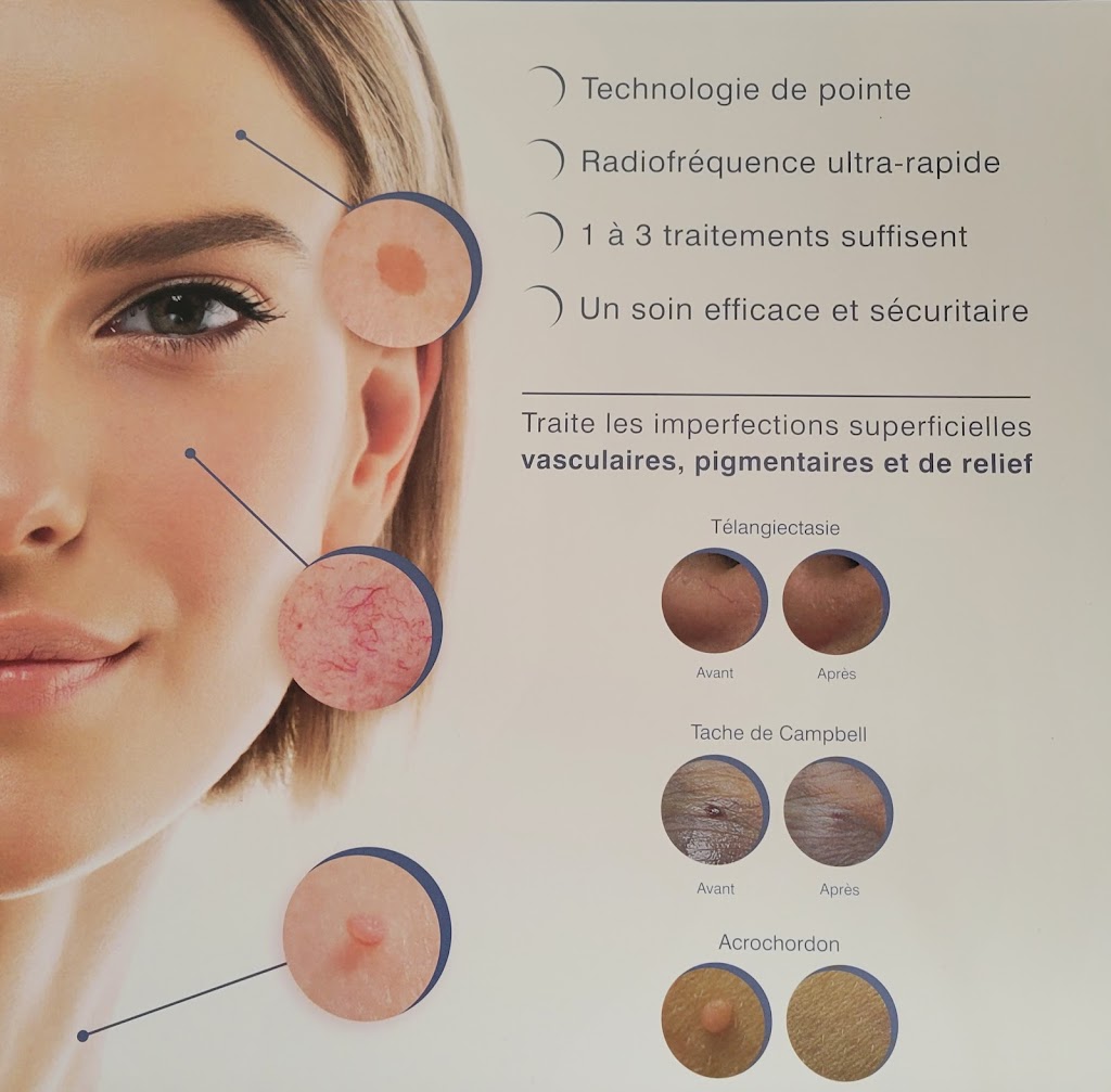 Beaute Esthetique Chantal | 295 A Bd Gagné, Sorel-Tracy, QC J3P 5X3, Canada | Phone: (450) 743-3421