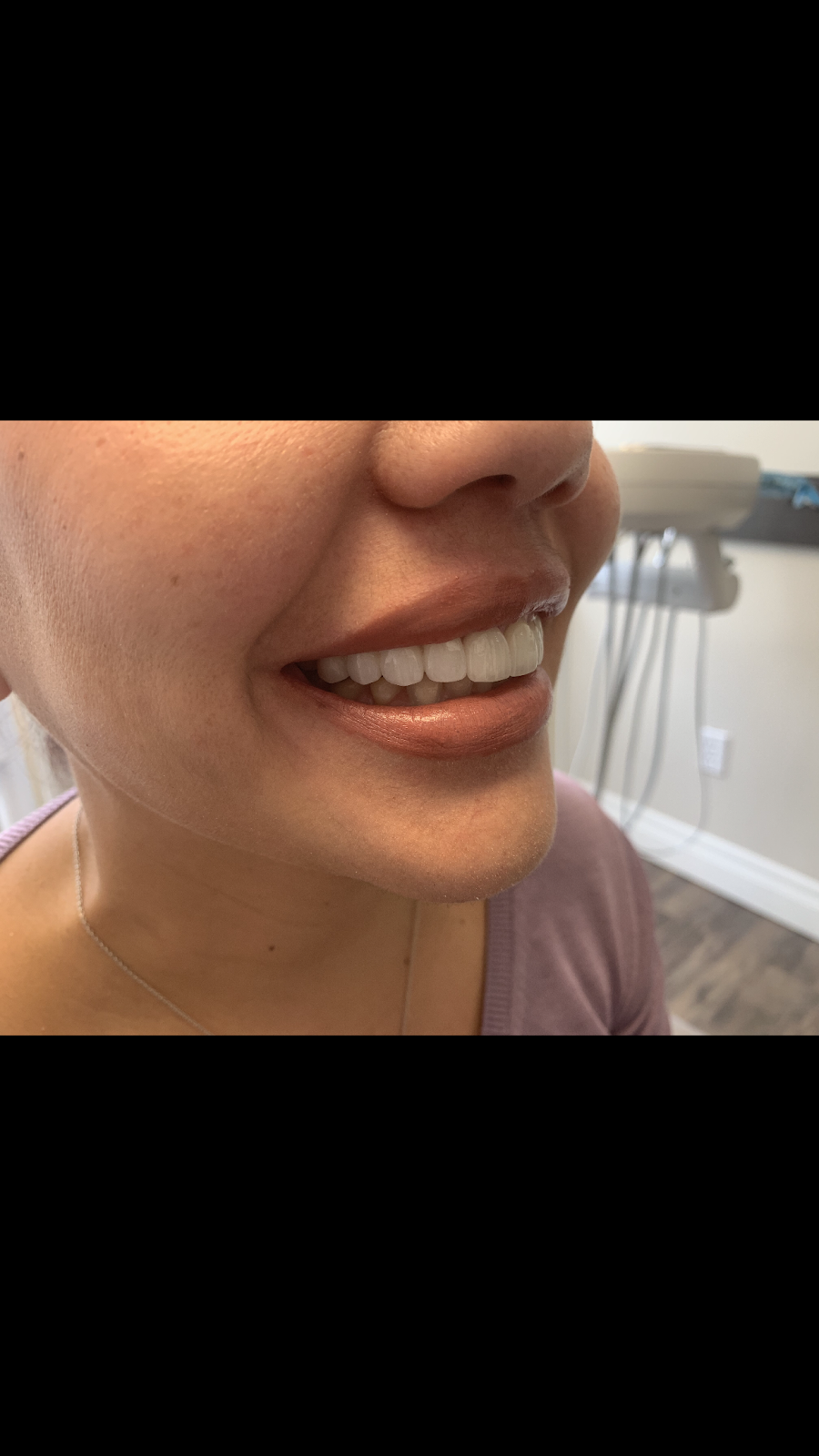 Swansea Dentistry | 2489 Bloor St W #103, Toronto, ON M6S 1R6, Canada | Phone: (416) 766-8005