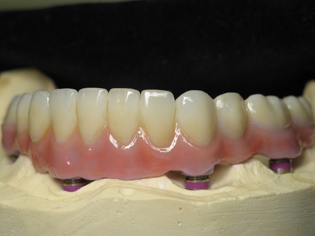 Inter Pro Dental Lab | 10578 109 St NW, Edmonton, AB T5H 3B2, Canada | Phone: (780) 429-2567