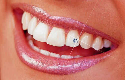 London Sherwood Dental Care | 1225 Wonderland Rd N #40b, London, ON N6G 2B9, Canada | Phone: (519) 601-1588