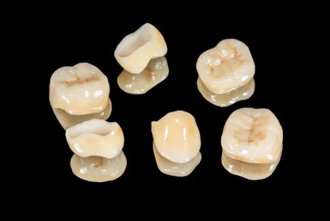 London Dental House by Dr. Joseph | 529 Queens Ave, London, ON N6B 1Y3, Canada | Phone: (519) 672-5600