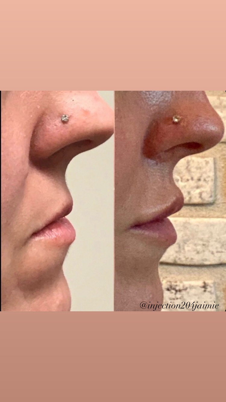 Injection204jaimie | 160 Provencher Blvd #101, Winnipeg, MB R2H 0G3, Canada | Phone: (204) 925-9779