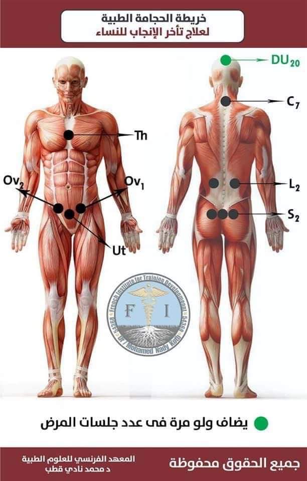 Hijama montreal clinic | 5805 Rue Lauzon, Montréal-Nord, QC H1G 2G9, Canada | Phone: (438) 221-5070