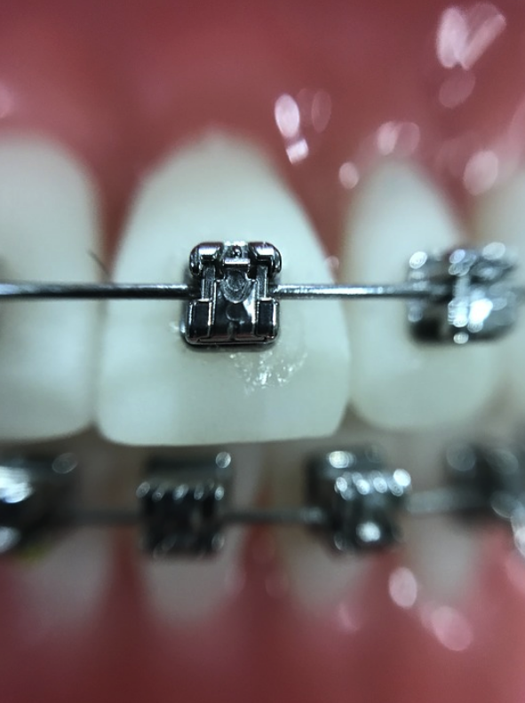 Dental Clinic Dr.Mansouri | 260 Boulevard Saint-Raymond #202, Gatineau, QC J9A 3G7, Canada | Phone: (819) 595-3444