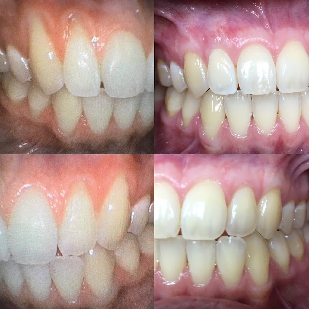 Burnaby Square Dental | 7885 6th St #210, Burnaby, BC V3N 3N4, Canada | Phone: (604) 526-2725