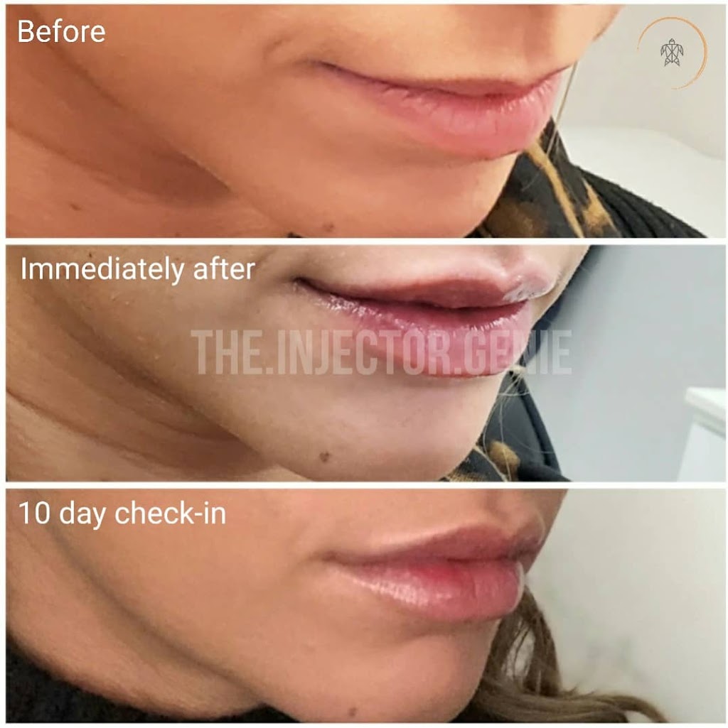 S.M.L.L Skin Solutions | 1092 Islington Ave Unit #201, Etobicoke, ON M8Z 4R9, Canada | Phone: (416) 417-2516
