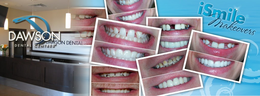 Dawson Dental Centre | 235 Ira Needles Blvd, Kitchener, ON N2N 3K6, Canada | Phone: (519) 742-2010