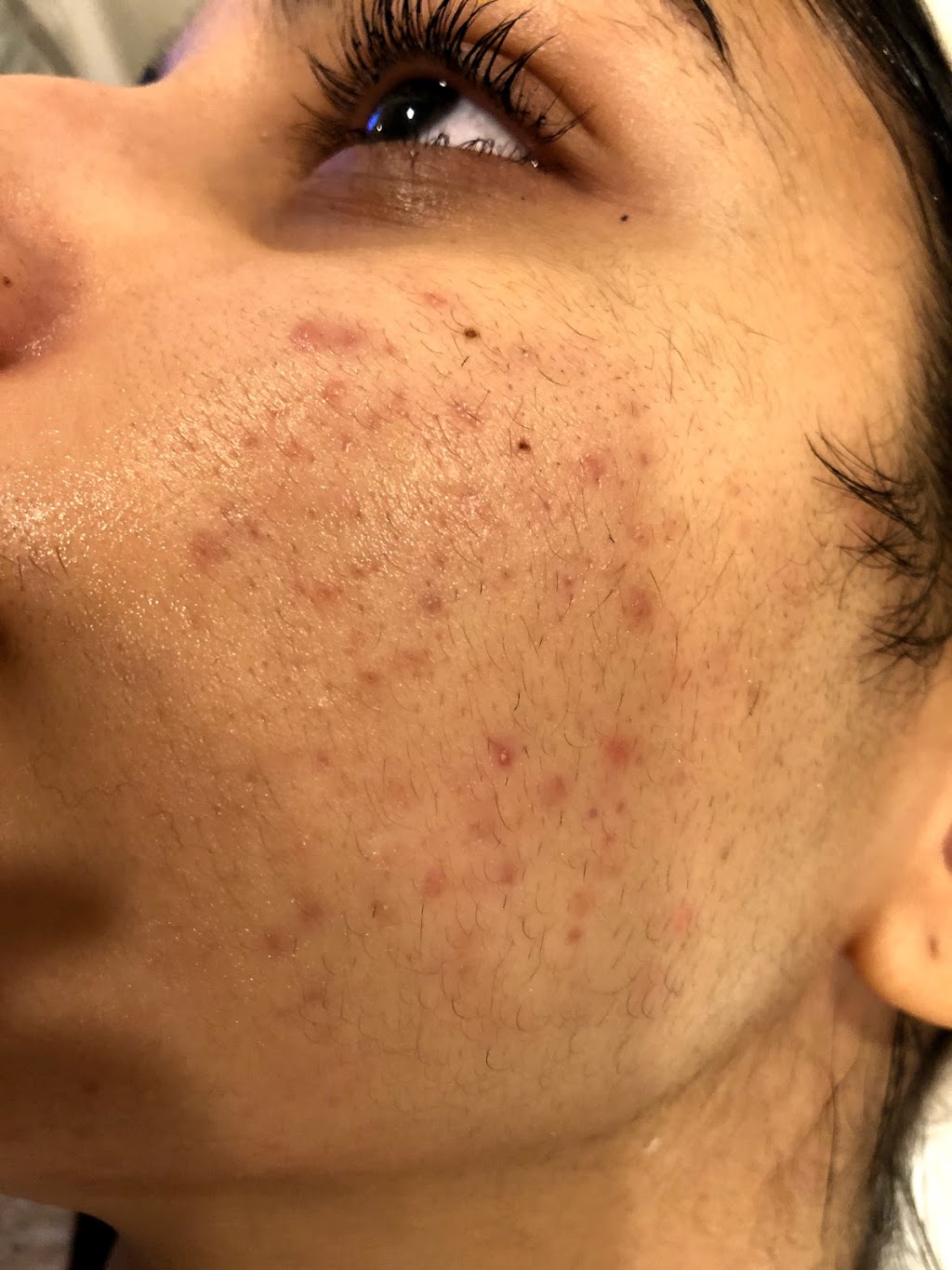 Spadana Spa & Laser Clinic | 44 Levendale Rd, Richmond Hill, ON L4C 4H2, Canada | Phone: (416) 877-0560