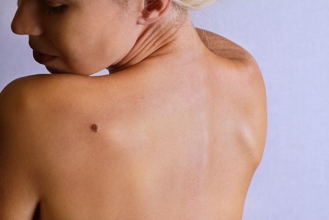 COSMEDERM | 4169 King St E, Kitchener, ON N2P 2E8, Canada | Phone: (519) 885-0222
