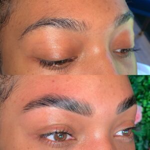 Get Beautiful Cosmetic Clinic | 3630 Lawrence Ave E, Scarborough, ON M1G 1P6, Canada | Phone: (647) 660-0860