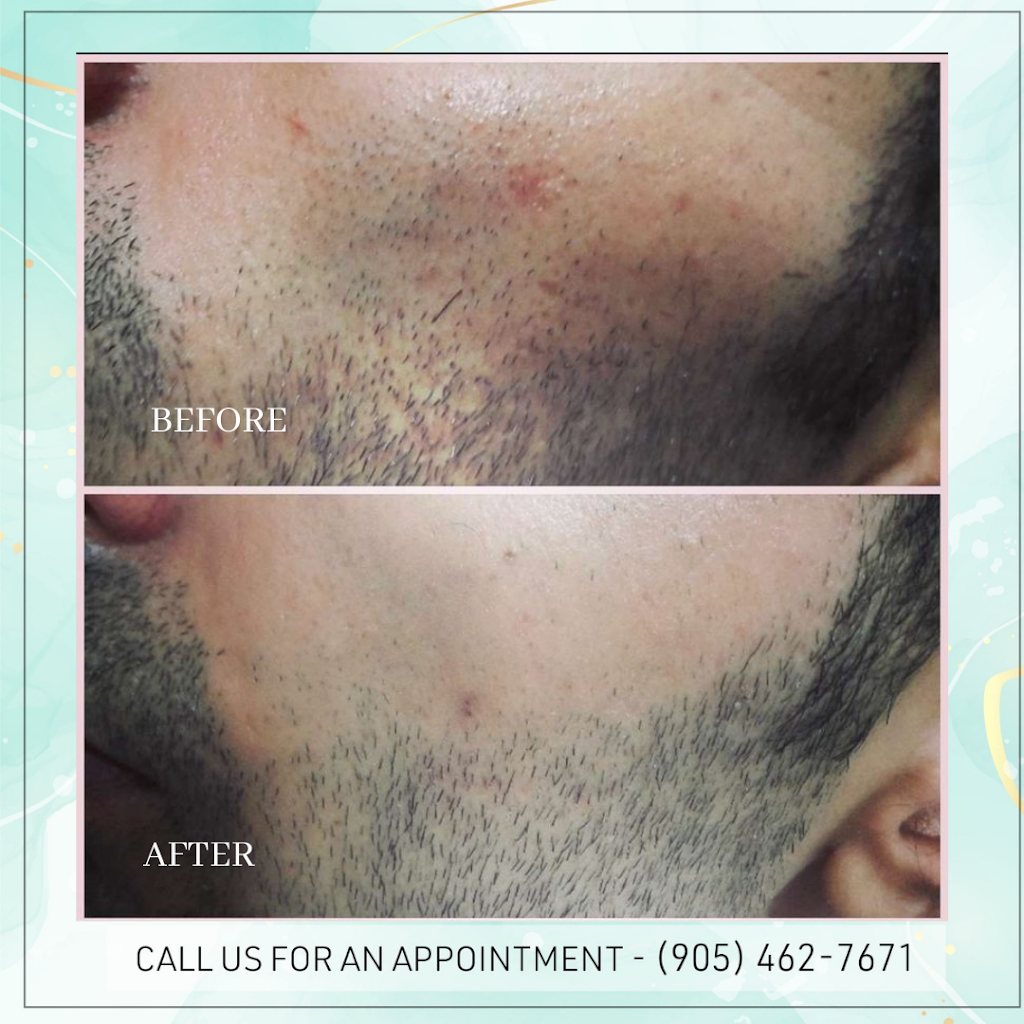 Glamderm Med Spa | 32 Village Centre Pl Suite 103 &104, Mississauga, ON L4Z 1V9, Canada | Phone: (905) 462-7671