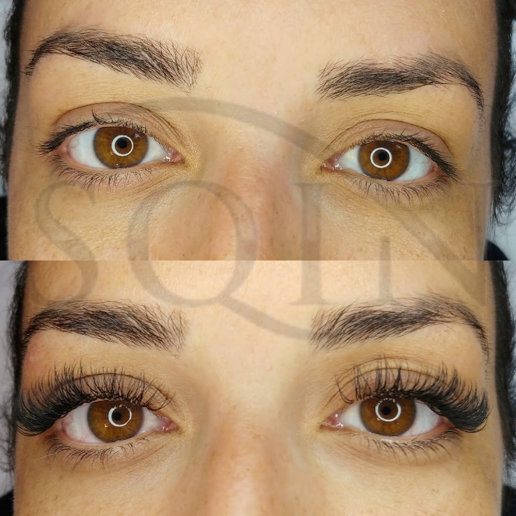 SQIN Med | 6150 Valley Way Unit 105, Niagara Falls, ON L2E 1X9, Canada | Phone: (905) 358-7746