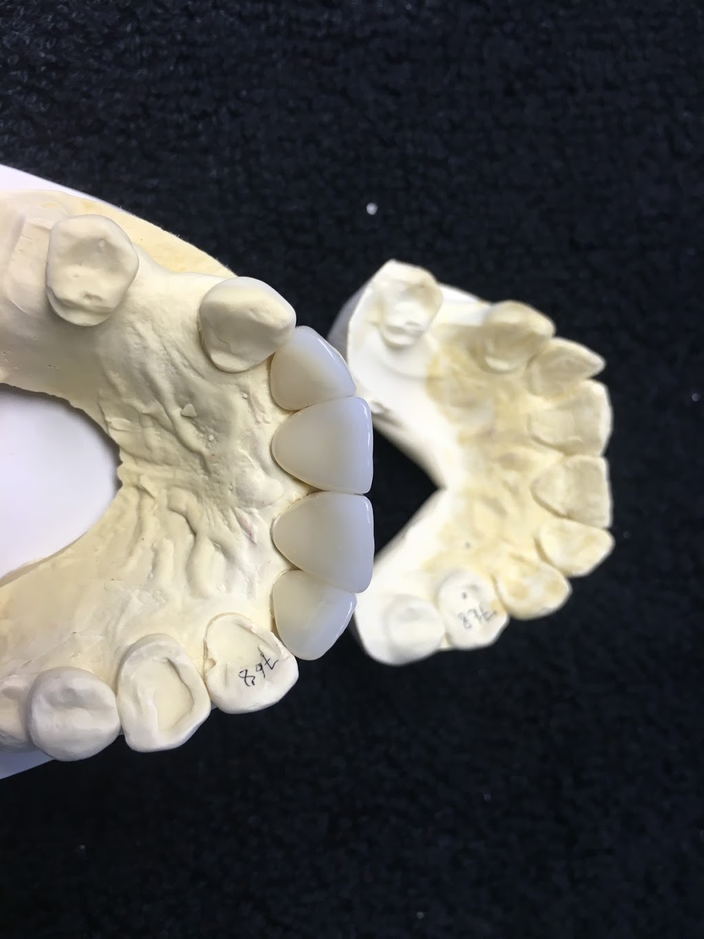 Proceram Dental Arts | 203-34654 Delair Rd, Abbotsford, BC V2S 2C9, Canada | Phone: (604) 853-7793