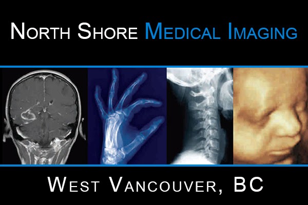 North Shore Medical Imaging | 110, 575 16th St, West Vancouver, BC V7V 4Y1, Canada | Phone: (604) 922-9141
