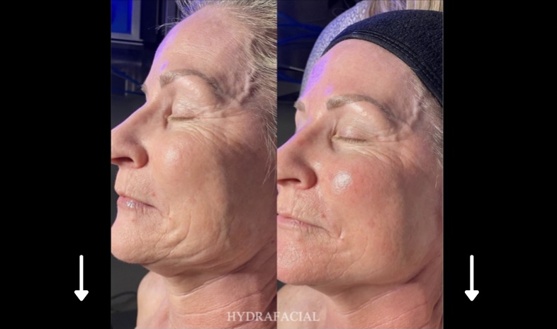 Fresca Beauty | 1949 Weston Rd, Toronto, ON M9N 1W8, Canada | Phone: (647) 696-6184