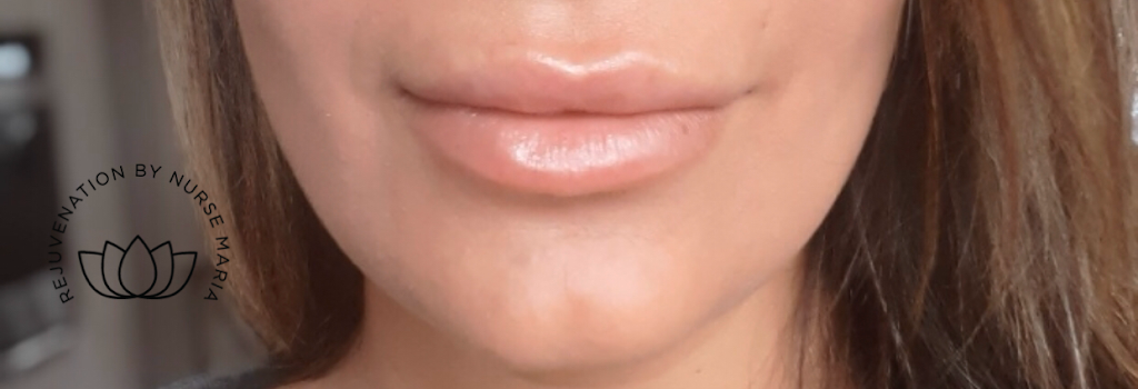 New Tec Cosmetic Rejuvenation | 35 Wolfe Ave Tottenham L0G1W0, 100 Bass Pro Mills Dr Unit 42, Vaughan, ON L4K 5X1, Canada | Phone: (416) 605-3646