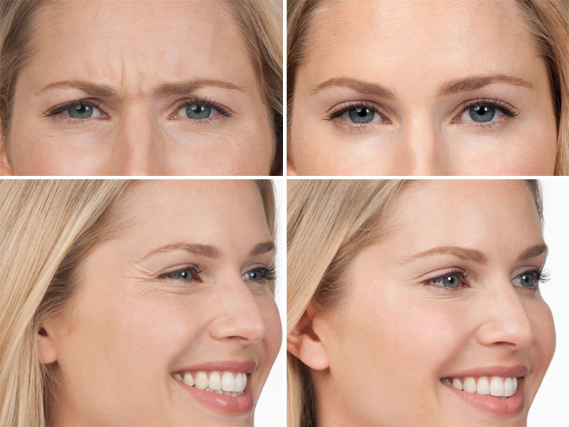 Vancouver Laser Center | 2121 Marine Dr #260, West Vancouver, BC V7V 4Y2, Canada | Phone: (604) 704-5903