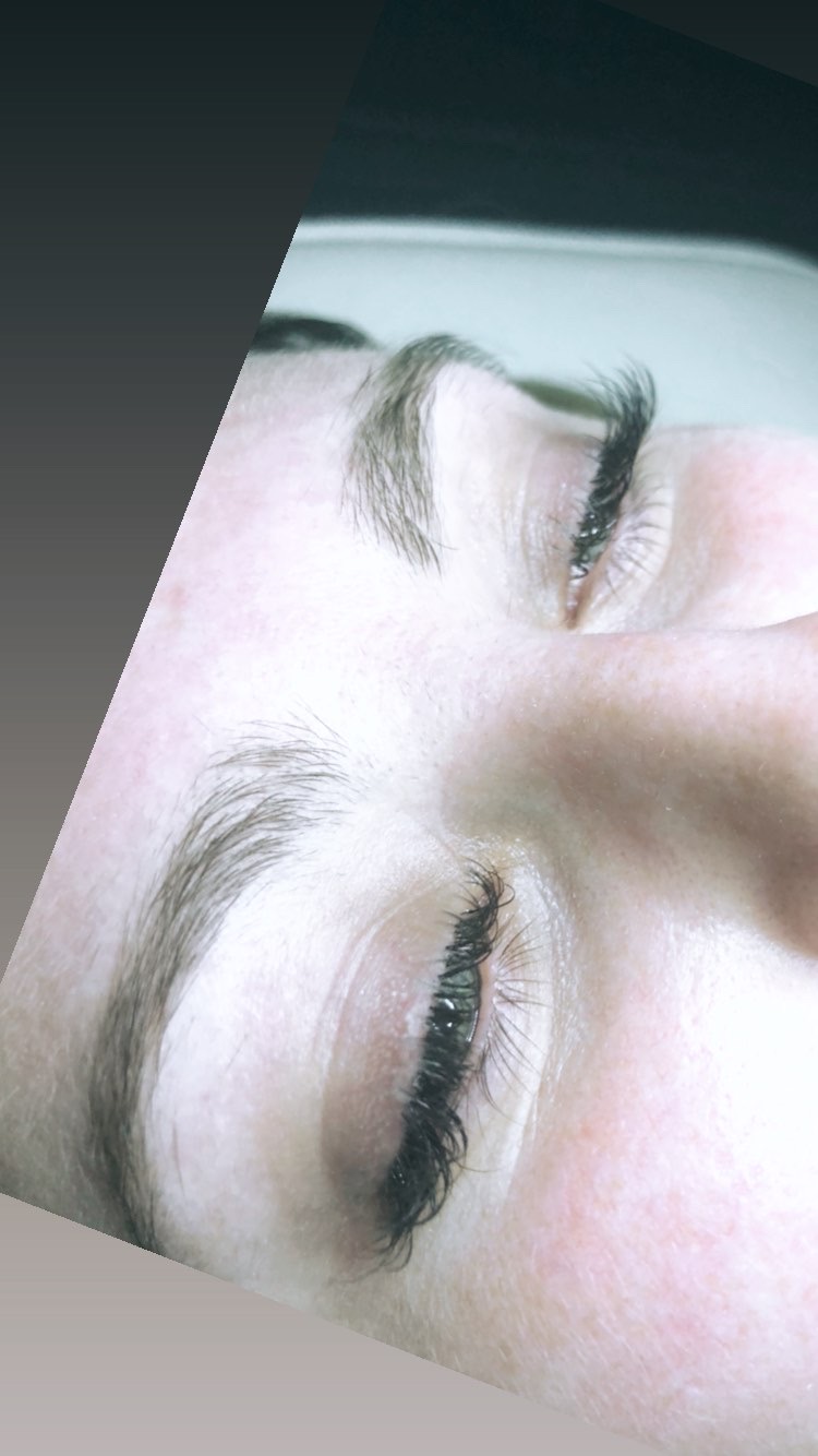 AGAESTHETICS | 6172 William St, Niagara Falls, ON L2E 5S1, Canada | Phone: (905) 321-9535