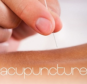 Acupuncture in Royal Vista | 164 Panamount Way NW, Calgary, AB T3K 0P7, Canada | Phone: (403) 993-3202