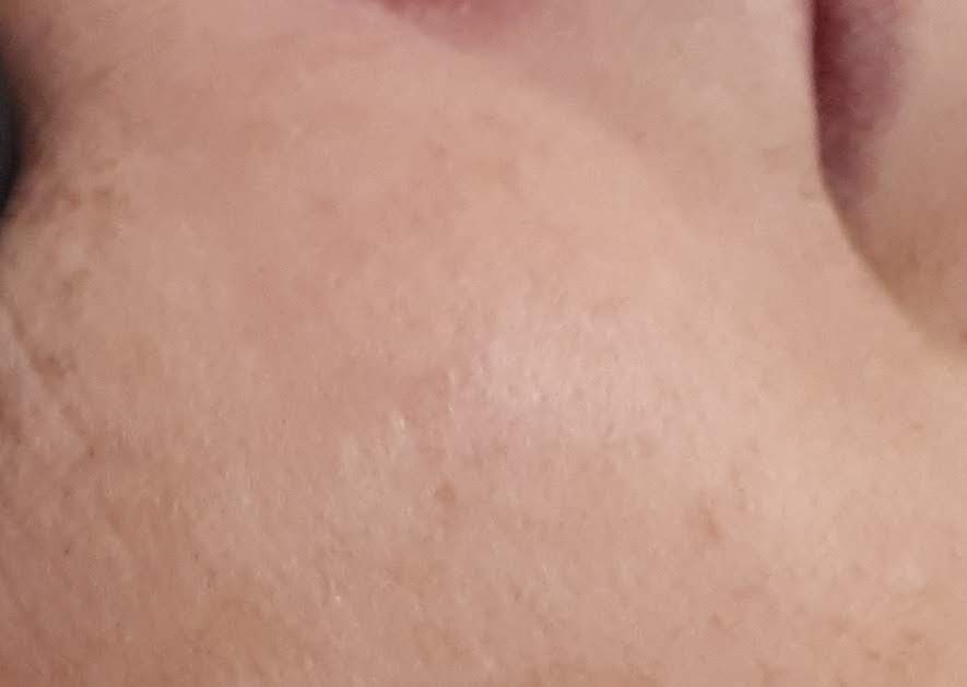 SkinLaser Beauty by Carrie | 168 McGill Dr, Janetville, ON L0B 1K0, Canada | Phone: (705) 341-1909