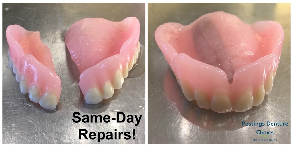 Postings Denture Clinic | 2227 James White Blvd #3, Sidney, BC V8L 1Z5, Canada | Phone: (250) 655-7009