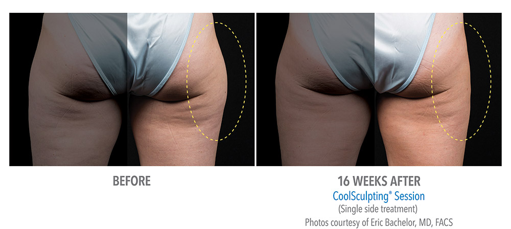 MediSpa At Gates Medical Centre | 14-300 Kingston Rd, Pickering, ON L1V 6Z9, Canada | Phone: (289) 275-0885