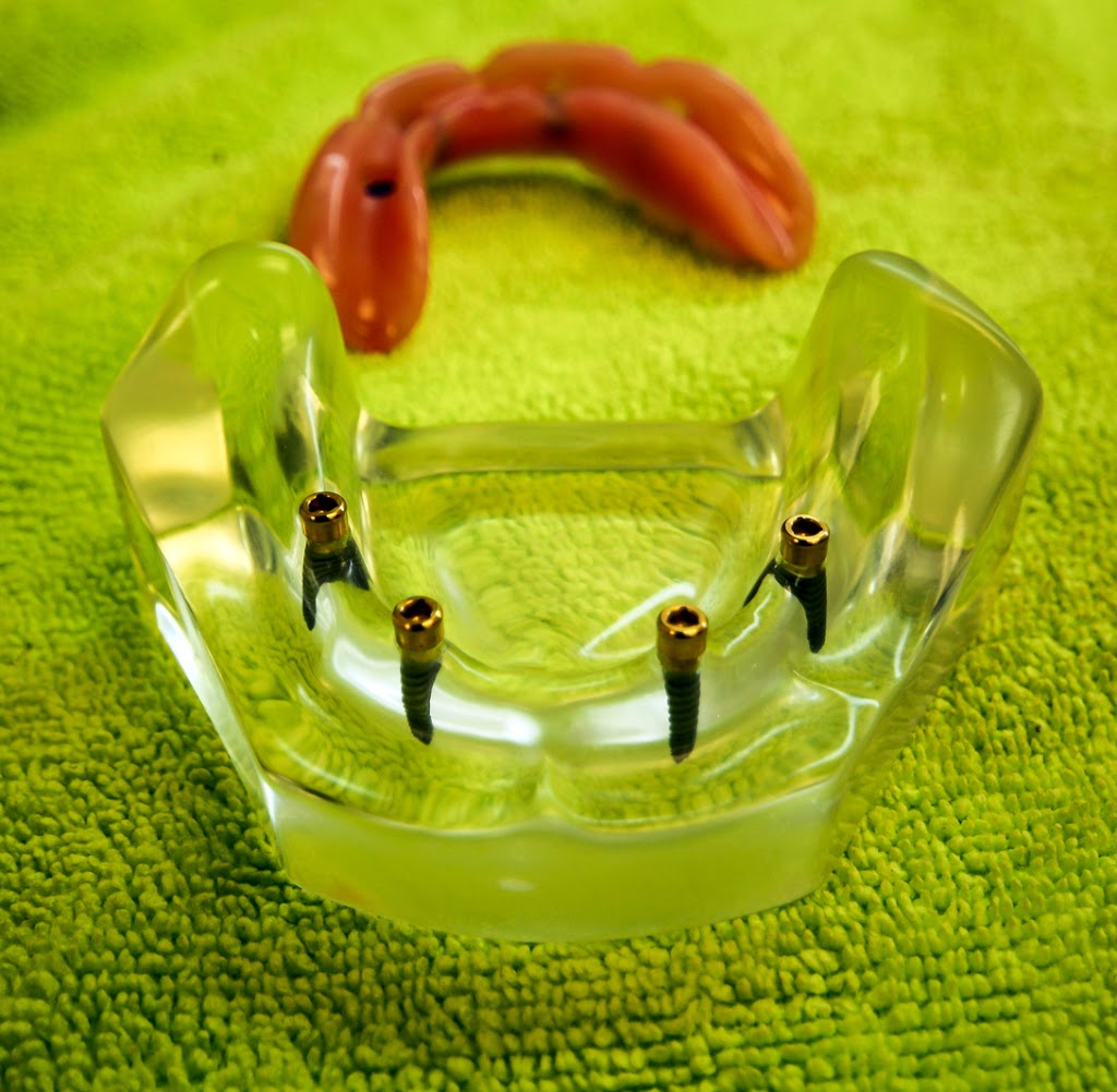 Peter Nikolovski Denture Clinic | 797 Princess St #107, Kingston, ON K7L 1G1, Canada | Phone: (613) 549-1184