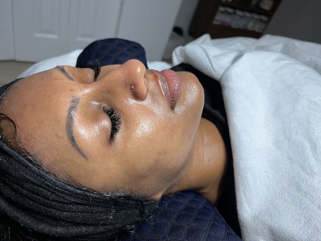 Rejuvia Aesthetics | 35 Toohey Ln, London, ON N6G 4Y2, Canada | Phone: (226) 639-5545