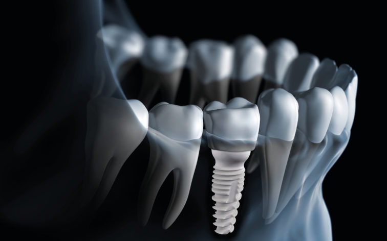 Dentistry @ Prescott | 555 King St W #3, Prescott, ON K0E 1T0, Canada | Phone: (613) 925-2887